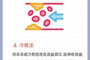 丧尸创伤急救指南DayZ玩家必学止血技巧与感染防护实战教程