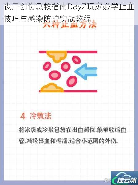 丧尸创伤急救指南DayZ玩家必学止血技巧与感染防护实战教程